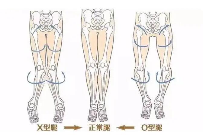 一介粗人·腿型矫正视频教程